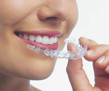 Invisalign and Children – A Good Fit?